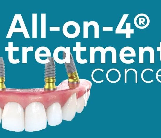All-on-4 implants with Zirconia Teeth – Promotion