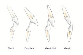 Dental occlusion and TMJ treatment