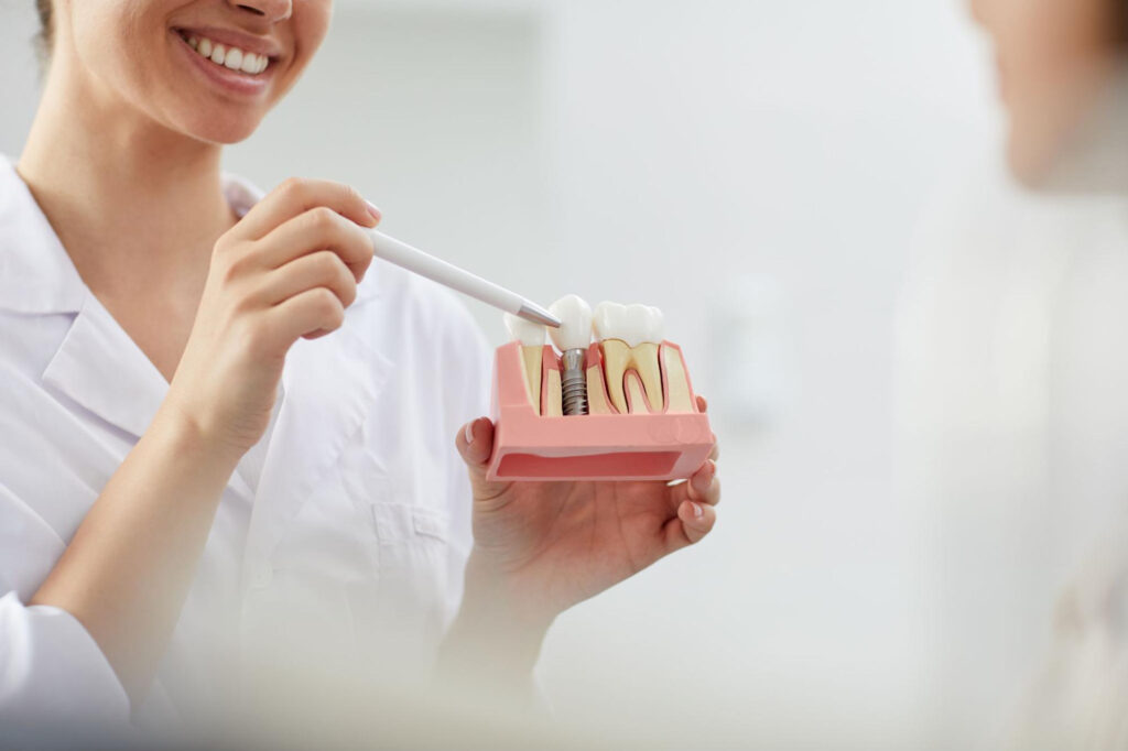 Understanding the Benefits of Dental Implants