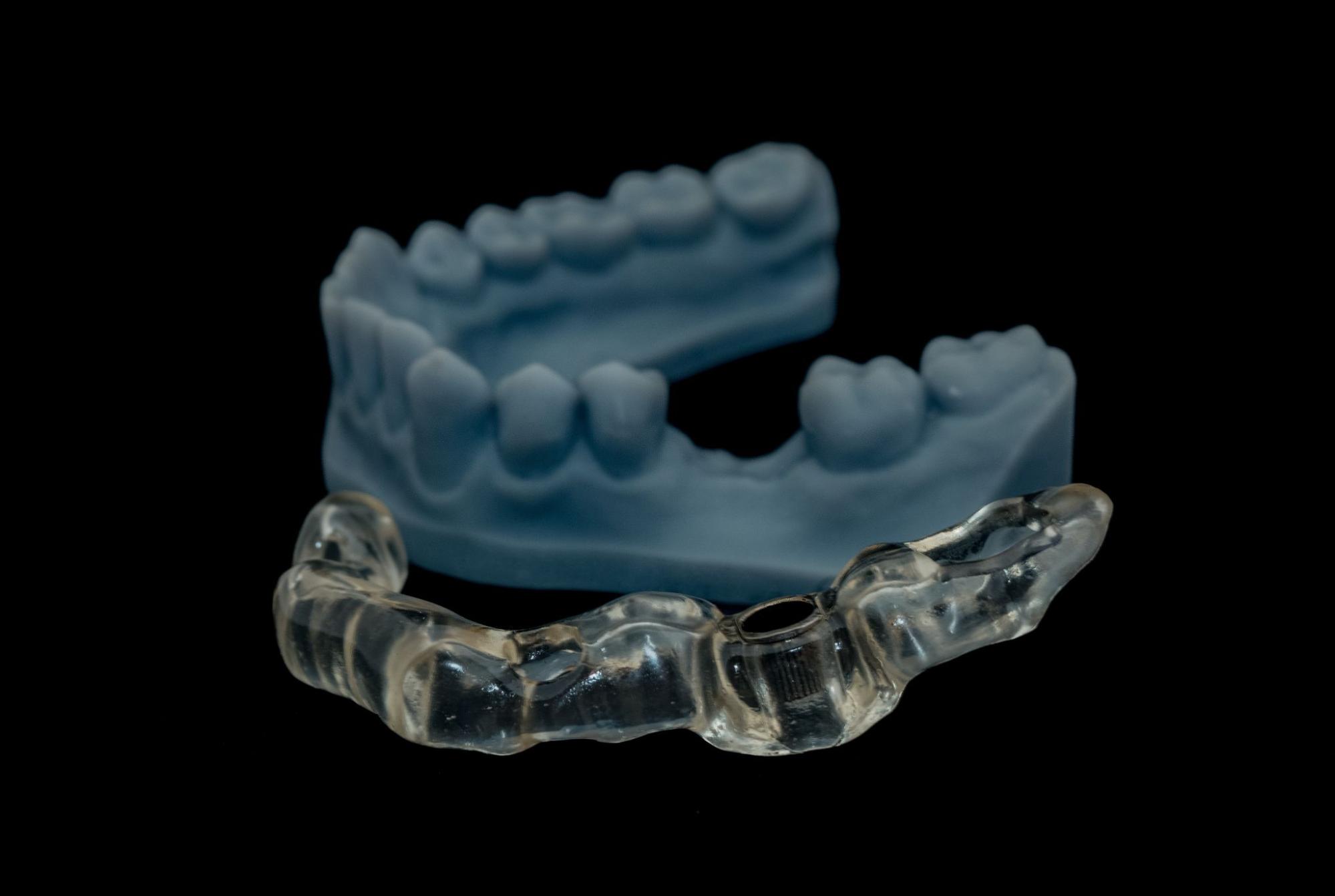 A 3D-printed surgical guide that allows for implants to be placed with high precision and accuracy
