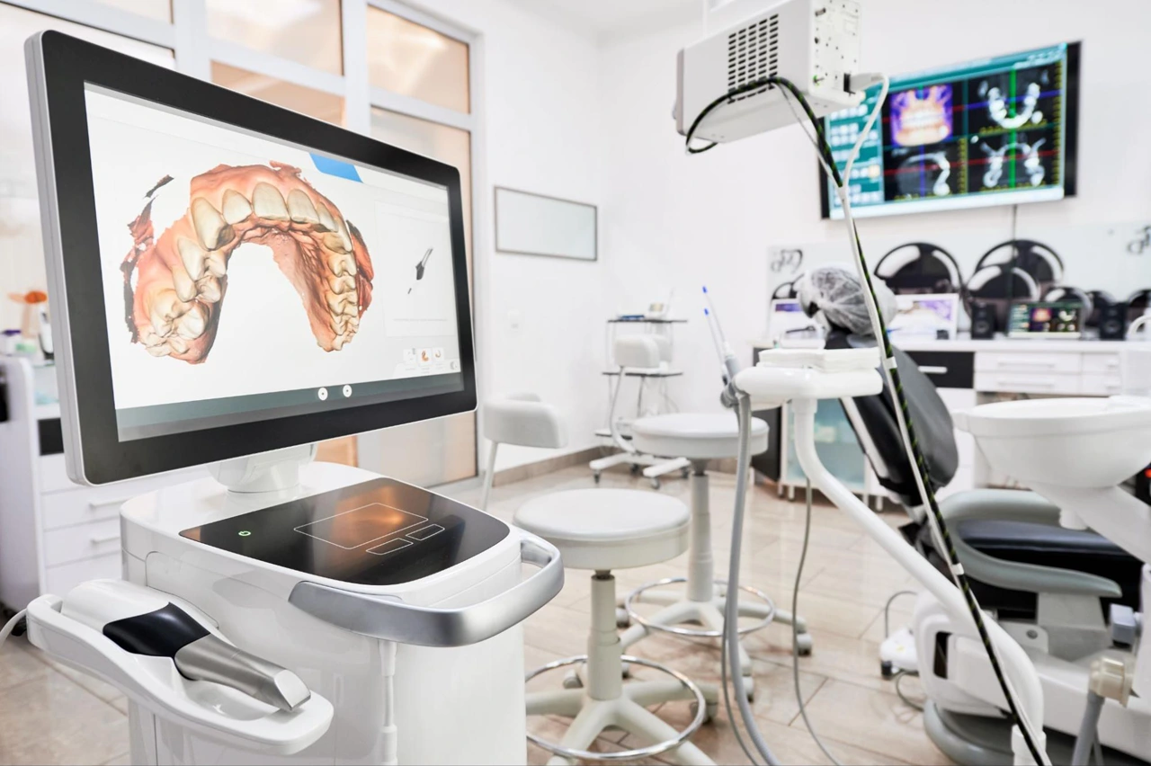 An in-house 3D scanner used to capture high-quality intra-oral photos