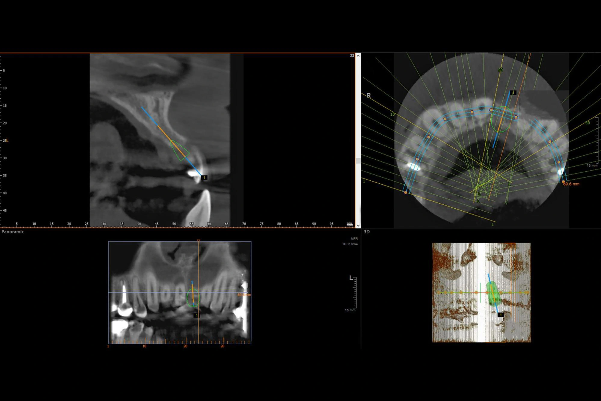 Advanced 3D CT scans 