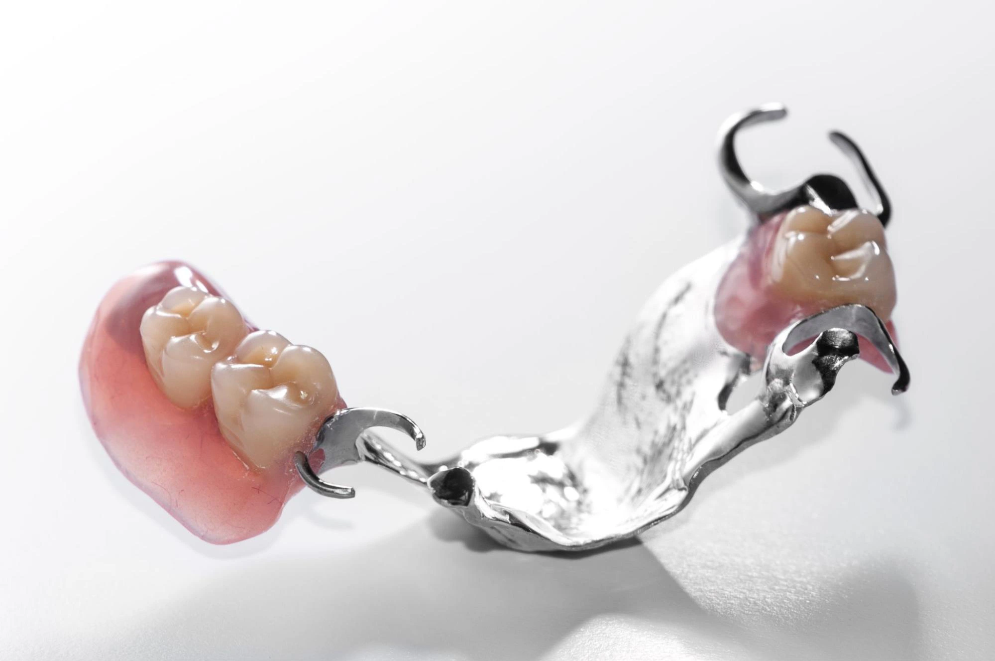 Cast metal partial denture
